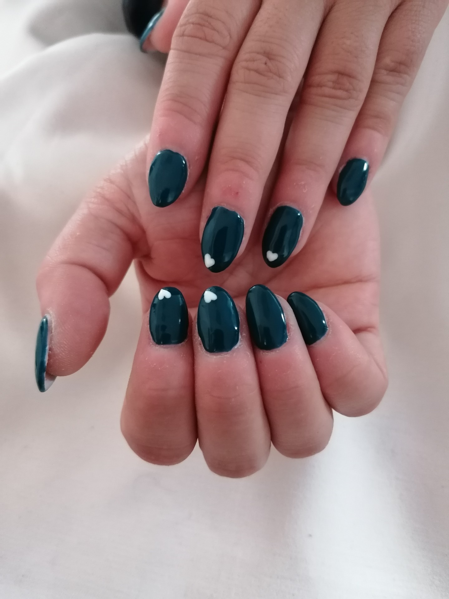 ongle