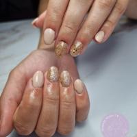 remplissage gel
