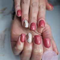 remplissage gel