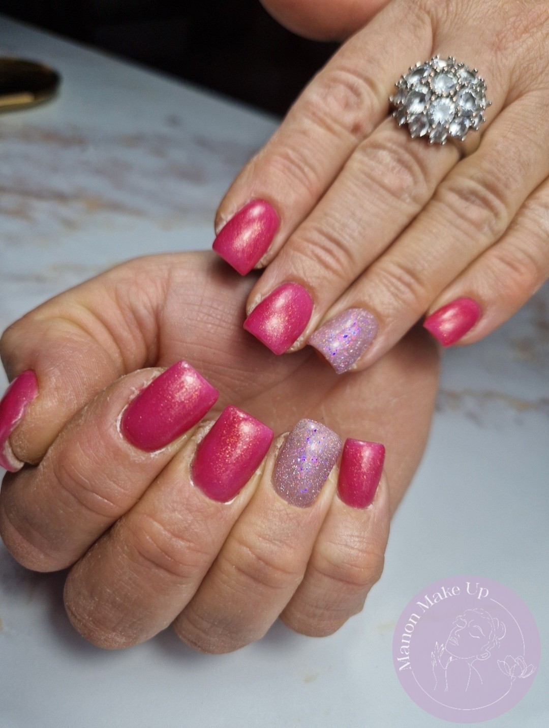 remplissage gel