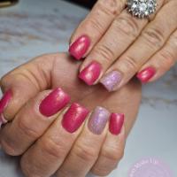 remplissage gel