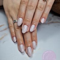 remplissage gel