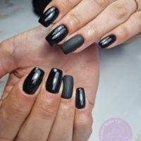 remplissage gel