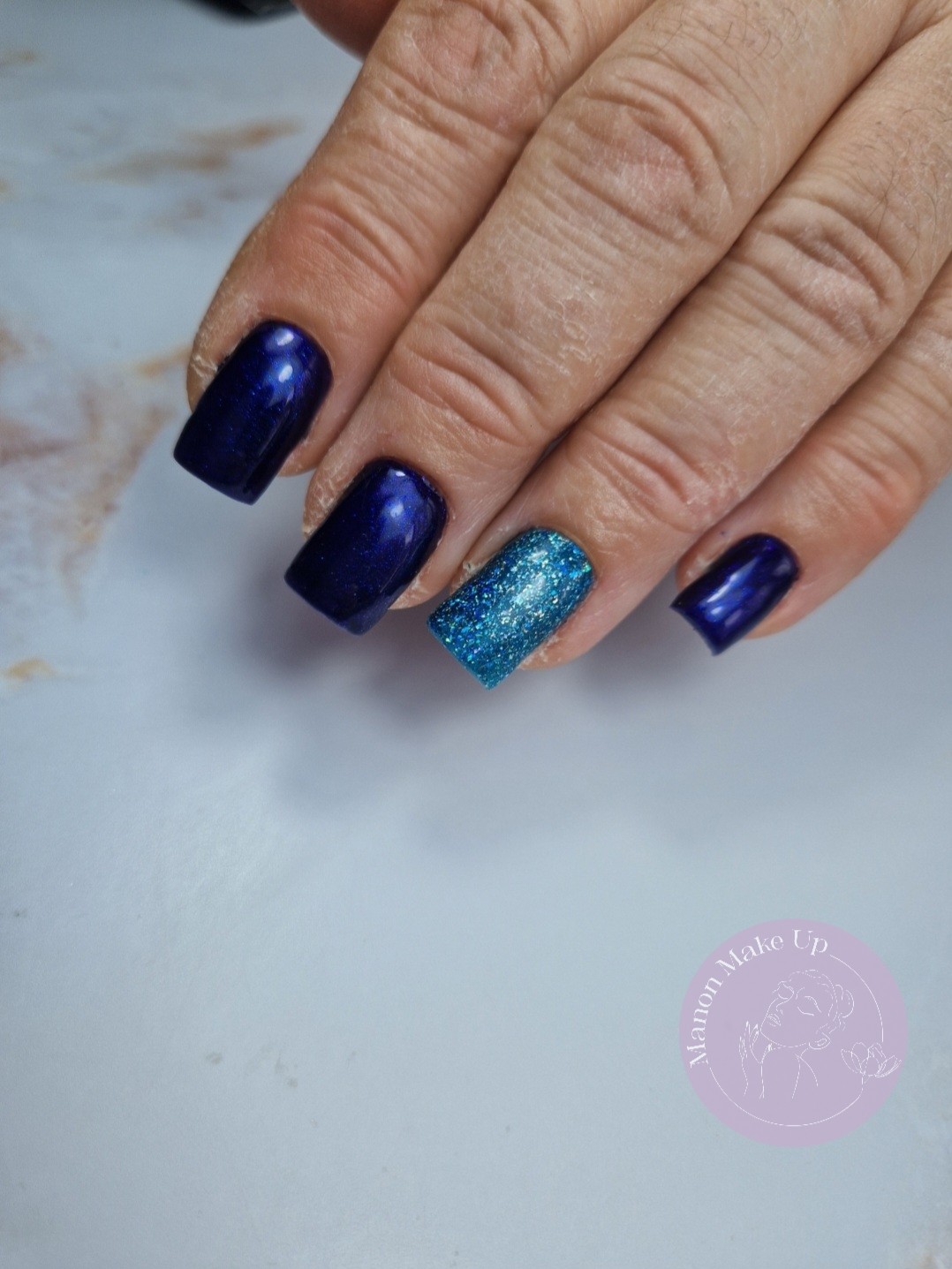 remplissage gel