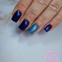 remplissage gel