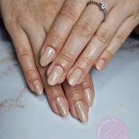 remplissage gel