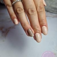 remplissage gel