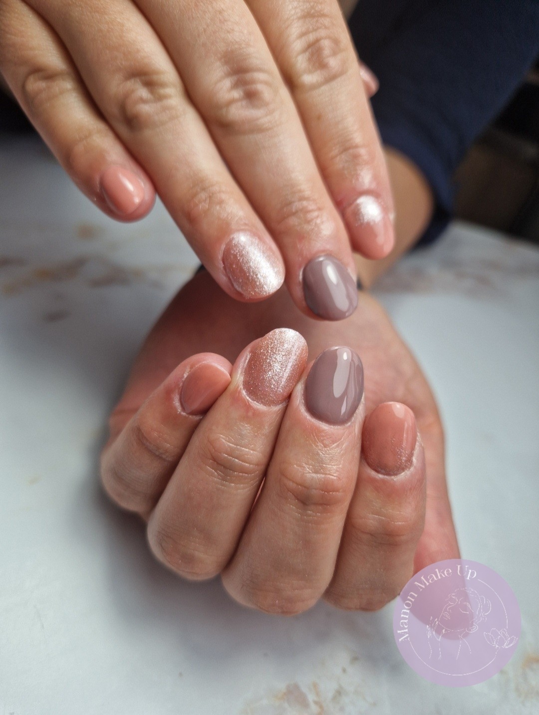 remplissage gel