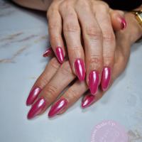remplissage gel