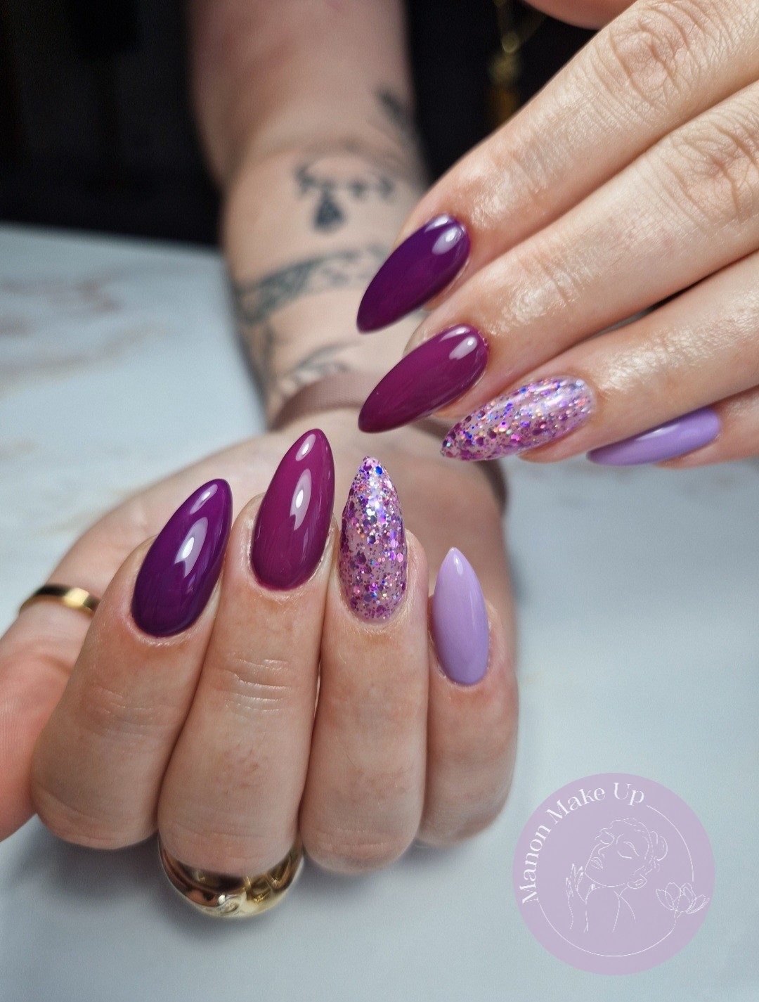 remplissage gel