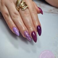 remplissage gel