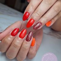 remplissage gel