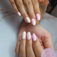remplissage gel