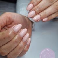 remplissage gel